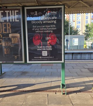 Bloody Amazing Kidneys campaign Cardiff Queen St