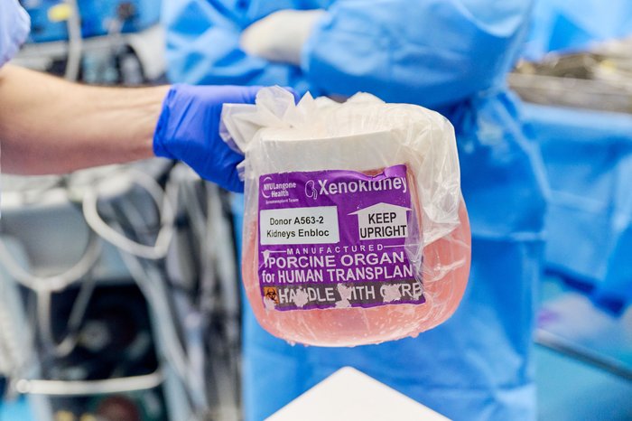 Xenotransplant Jan 2024 (Carrotta-KidneyXeno#7-037)