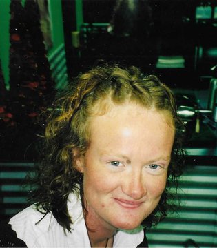 Deirdre Pim - during dialysis
