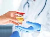 Dent disease - urine sample