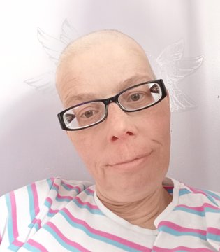 Mariann Alexander - during chemotherapy