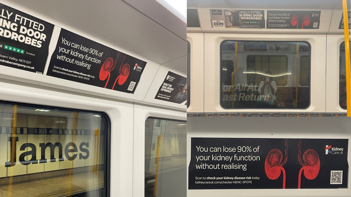 Newcastle Metro BAK