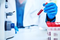 NPHP - blood sample