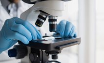 Retroperitoneal fibrosis - lab test