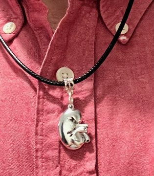 Tony Chaplin - kidney transplant necklace close up