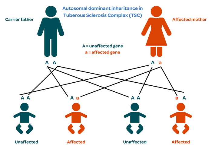 Tuberous sclerosis inheritance diagram