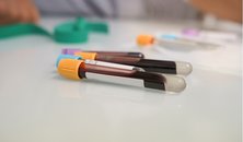 Blood test tubes